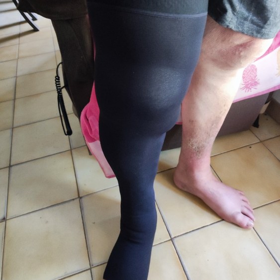 Bas de compression