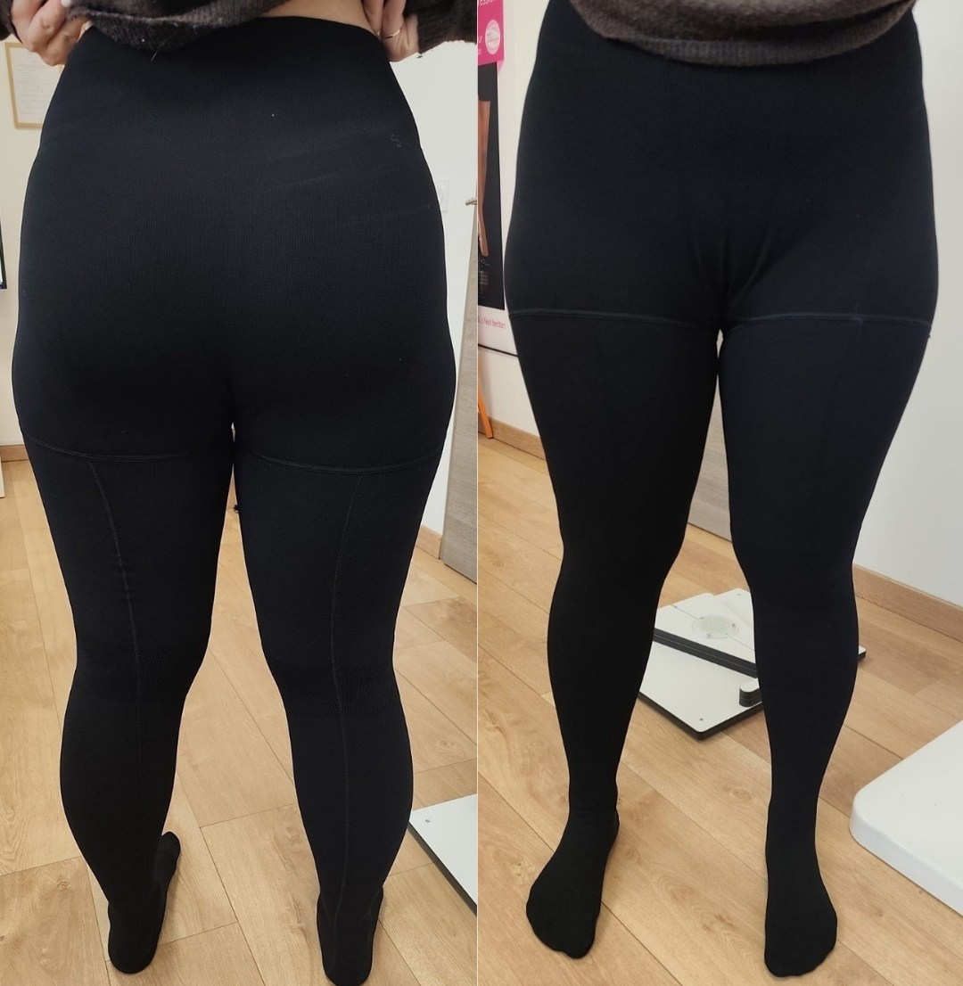 Tendinite du tenseur du fascia lata